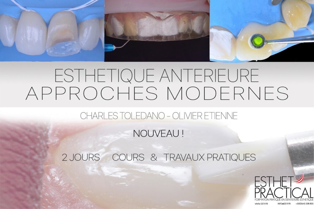 Les traitements esthétiques antérieurs | Mentora by French Tooth